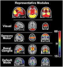 A mágneses rezonancia készülék segít az agynak